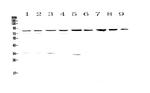 CD2AP Antibody in Western Blot (WB)