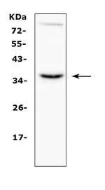 CD154 (CD40 Ligand) Antibody in Western Blot (WB)