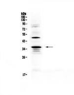 CD154 (CD40 Ligand) Antibody in Western Blot (WB)