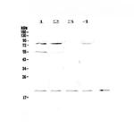 CD59 Antibody in Western Blot (WB)