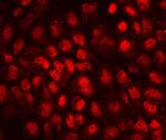 CD79b Antibody in Immunocytochemistry (ICC/IF)