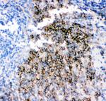 CD79b Antibody in Immunohistochemistry (Paraffin) (IHC (P))