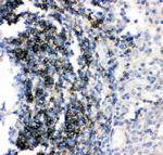 CD79b Antibody in Immunohistochemistry (Paraffin) (IHC (P))