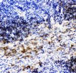 CD79b Antibody in Immunohistochemistry (Paraffin) (IHC (P))