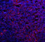 CD80 (B7-1) Antibody in Immunohistochemistry (Paraffin) (IHC (P))