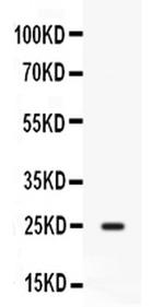 CD9 Antibody in Western Blot (WB)