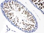 CDC6 Antibody in Immunohistochemistry (Paraffin) (IHC (P))