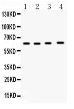 CDC6 Antibody in Western Blot (WB)