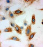 P-cadherin Antibody in Immunocytochemistry (ICC/IF)