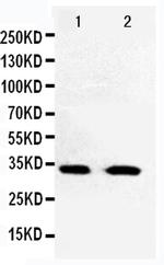 CDK5 Antibody in Western Blot (WB)