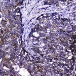 CDK6 Antibody in Immunohistochemistry (Paraffin) (IHC (P))