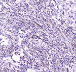 CES1 Antibody in Immunohistochemistry (Paraffin) (IHC (P))