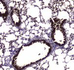 CES1 Antibody in Immunohistochemistry (Paraffin) (IHC (P))