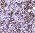 CES1 Antibody in Immunohistochemistry (Paraffin) (IHC (P))