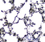 CES1 Antibody in Immunohistochemistry (Paraffin) (IHC (P))