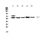 CES1 Antibody in Western Blot (WB)