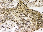 CHK2 Antibody in Immunohistochemistry (Paraffin) (IHC (P))