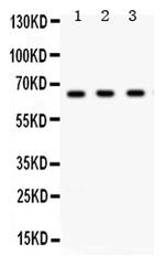 CHK2 Antibody in Western Blot (WB)