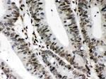 CIITA Antibody in Immunohistochemistry (Paraffin) (IHC (P))