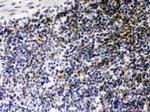 CIITA Antibody in Immunohistochemistry (Paraffin) (IHC (P))