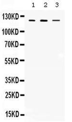 CIITA Antibody in Western Blot (WB)