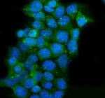 CLPP Antibody in Immunocytochemistry (ICC/IF)