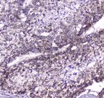 CLPP Antibody in Immunohistochemistry (Paraffin) (IHC (P))