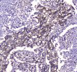 CLPP Antibody in Immunohistochemistry (Paraffin) (IHC (P))