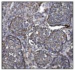 CLPP Antibody in Immunohistochemistry (Paraffin) (IHC (P))