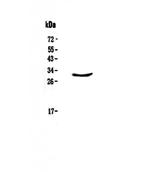 CLPP Antibody in Western Blot (WB)