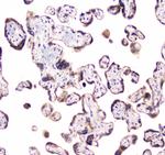 CLPX Antibody in Immunohistochemistry (Paraffin) (IHC (P))