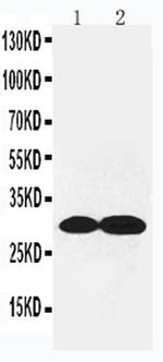 COL4A2 Antibody in Western Blot (WB)