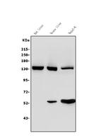 Ceruloplasmin Antibody in Western Blot (WB)