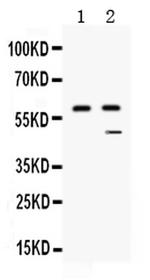 Carboxypeptidase B2 Antibody in Western Blot (WB)