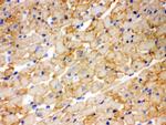 CPT1B Antibody in Immunohistochemistry (Frozen) (IHC (F))