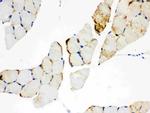 CPT1B Antibody in Immunohistochemistry (Paraffin) (IHC (P))