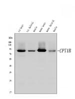 CPT1B Antibody in Western Blot (WB)