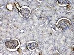 CRP Antibody in Immunohistochemistry (Paraffin) (IHC (P))