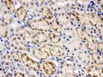 CRY2 Antibody in Immunohistochemistry (Paraffin) (IHC (P))