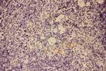 GM-CSF Antibody in Immunohistochemistry (Paraffin) (IHC (P))