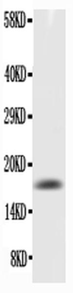 GM-CSF Antibody in Western Blot (WB)