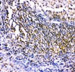 CSK Antibody in Immunohistochemistry (Paraffin) (IHC (P))