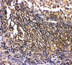 CSK Antibody in Immunohistochemistry (Paraffin) (IHC (P))