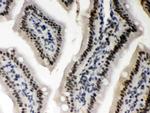 CK1 alpha Antibody in Immunohistochemistry (Paraffin) (IHC (P))