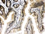 CTCF Antibody in Immunohistochemistry (Paraffin) (IHC (P))