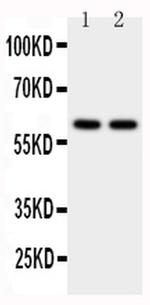 CYP11A1 Antibody in Western Blot (WB)