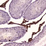 CYP17A1 Antibody in Immunohistochemistry (Paraffin) (IHC (P))