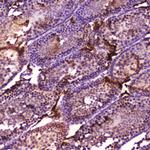 CYP17A1 Antibody in Immunohistochemistry (Paraffin) (IHC (P))