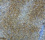 CYP2E1 Antibody in Immunohistochemistry (Paraffin) (IHC (P))