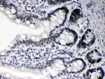 DAXX Antibody in Immunohistochemistry (Paraffin) (IHC (P))